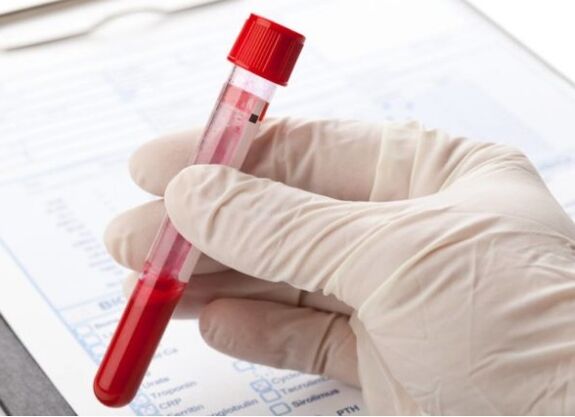 Laboratoire diagnostesch Methoden erlaabt Iech pathologesch Mikrofloa oder Virus z'identifizéieren
